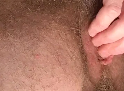 Close-up of Hairy Ftm Wanking, Cumming and Squirting