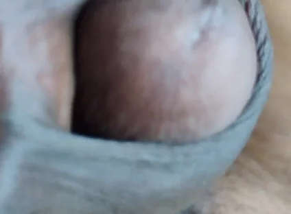My Penis