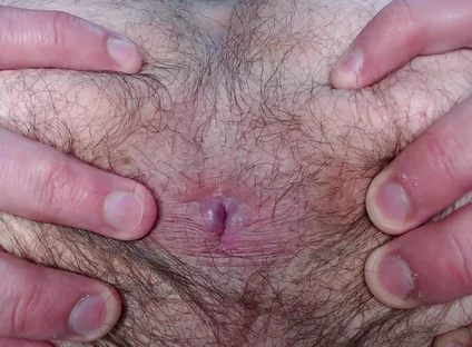 By Popular Demand, I Farted and Showed My Hairy Ass.