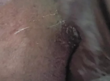 Closeup of My Ass!