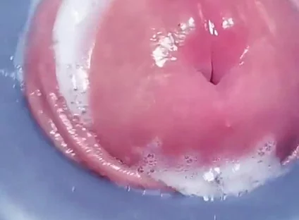 Penis Machine with a New Attachment