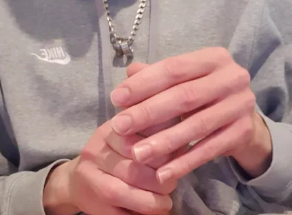 Skinny Lad Pulls Back Skin to Show Bellend