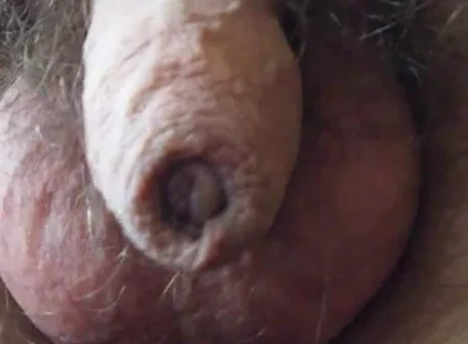 My Penis Walkabout