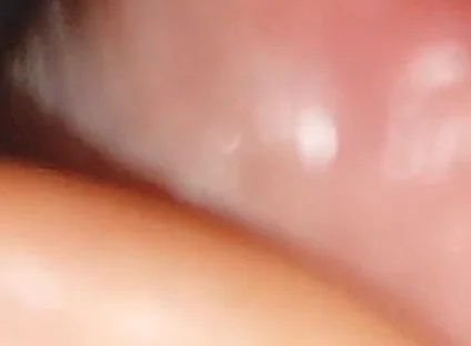 Hot Daddy in Close-up of the Inside of the Glans!