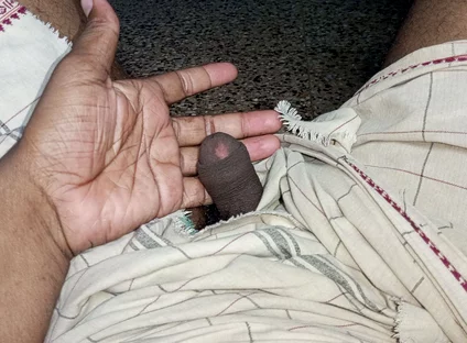 Masturbation