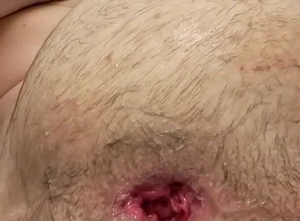 Teen Fisting Gaping Asshole Hard