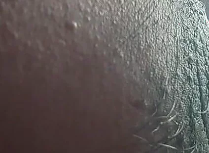 Armpit