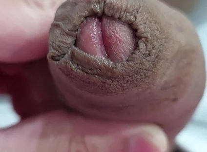 The Head of My Penis