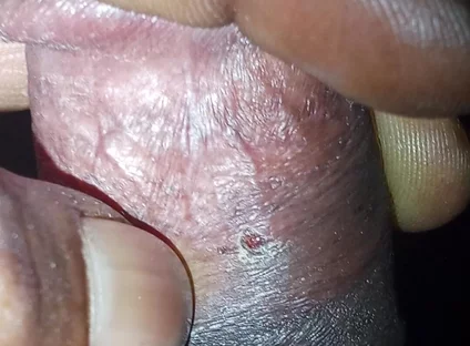 Now Videos