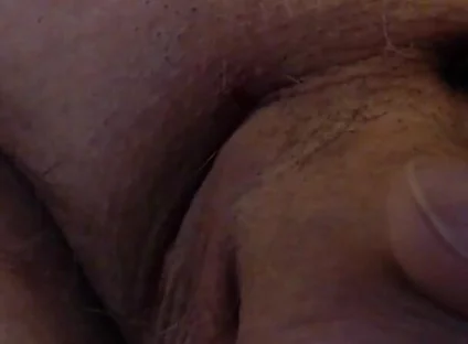 Limping Dick