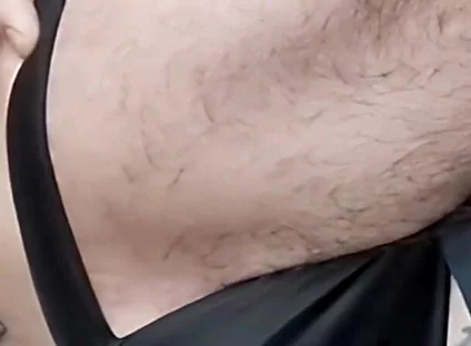 A Sperm Injection