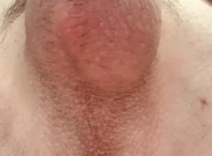 Do You Like Shaved or Hairy?