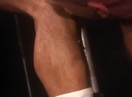Plexus