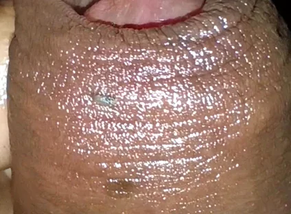 Close-up of Foreskin and Ejaculation in My Pants