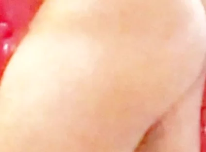 Whip-lash