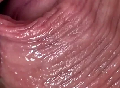 Cocksucker