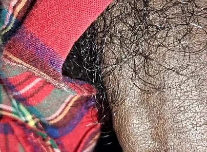 Close up on These Thick Veins