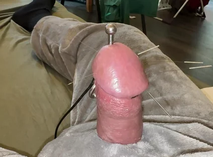 Acorn Acupuncture in a Cozy Cuddly Suit! Lots of Sperm!