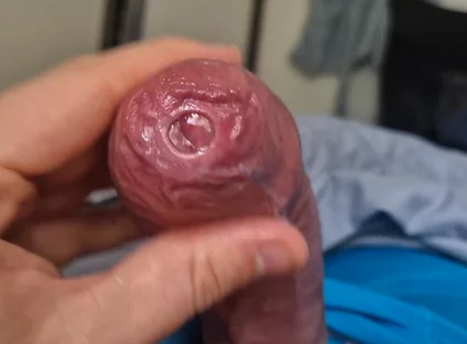 Phimosis Cock Precum Drip Close-up