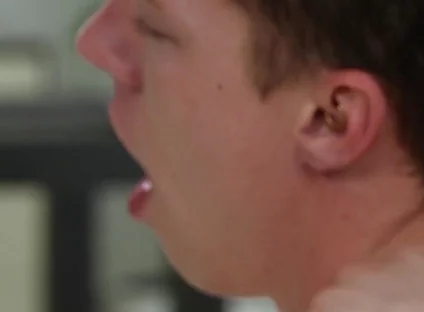 Exposed