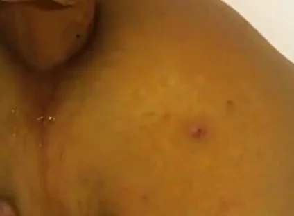 Deep in the Butt