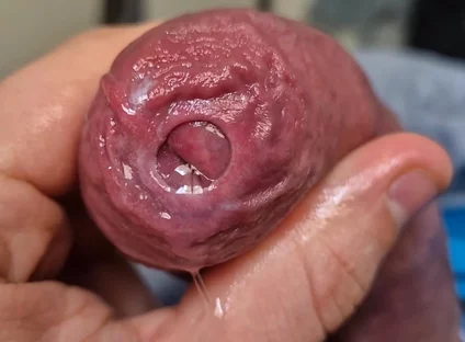Uncut Head Precum Play