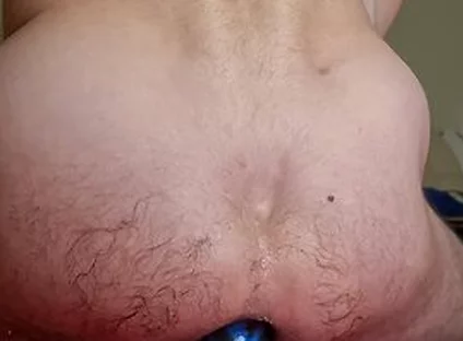Extreme Anal Stretching With My Huge Blue Egg Plug