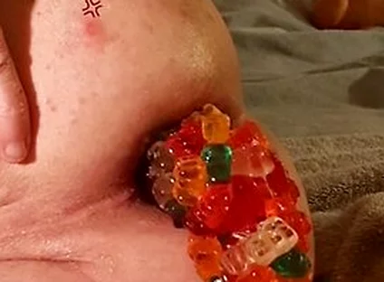 Big Load Of Gummy Bears Anal Stuffing And Expulsion Whit Prolapse