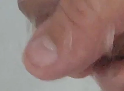 Strong Water in the Foreskin Excites the Glans Precum.