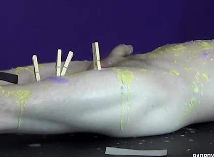 Pinching pegs leave welts