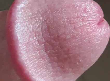Closeup of Penis with One Vein