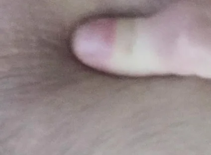 Dirty Anus