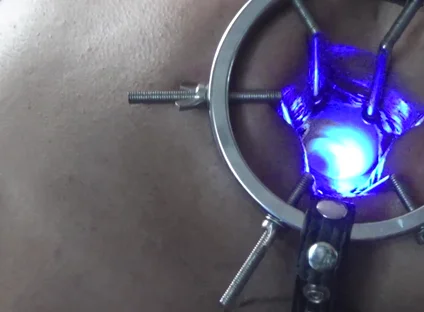 Backdoor Lightshow
