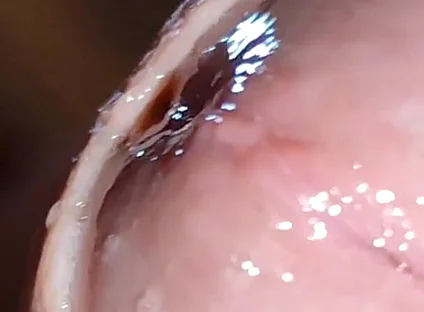 Glans Eye Watering After Intense Fucking.