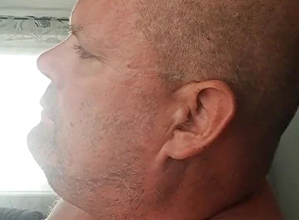 Renewed Destruction of the Bitch