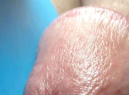 Hole Is Drilled Through