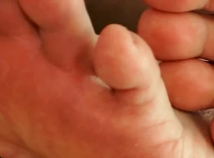 The Foot Master's Installation Protocol