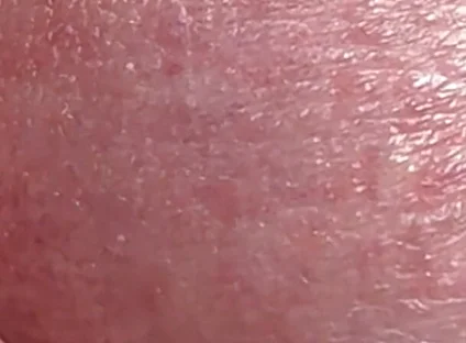 Sperm Close-up Front