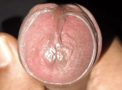 Telugu Abbayi Video