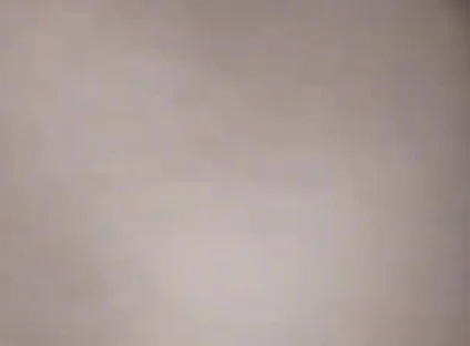 Destroying the Asshole on the Dick