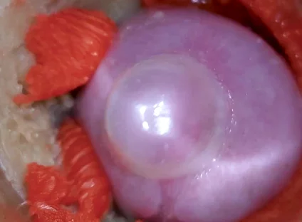 The Camera Inside the Deep Pussy Records a Huge Ejaculation with a Stuck Condom 4K