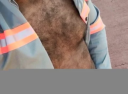 My Hairy Body