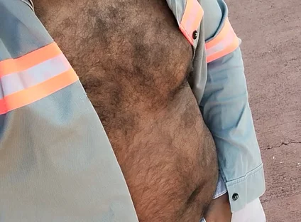 My Hairy Body