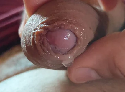 Close-up of Glans Ejaculating Intensely Before Cumming.