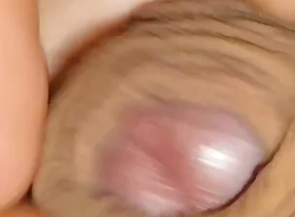 The World's Largest Foreskin Opening and Closing.