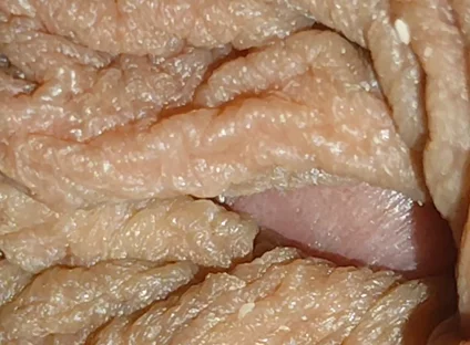 The World's Largest Foreskin Opening and Closing.
