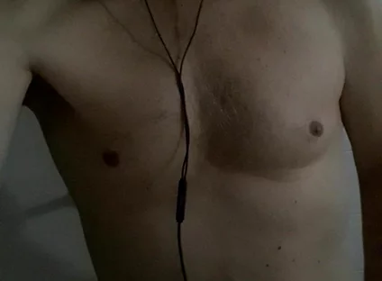 Pectoralis and Frontal