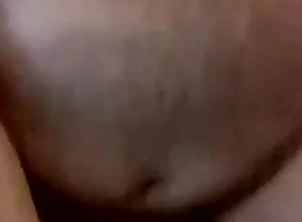 Daddy Saline Glucuse Sack