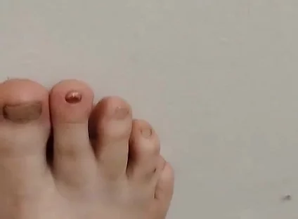 11-26-2025 Cute Little Toes