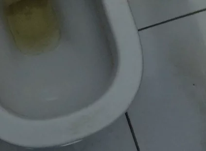 Homemade Method for Freezing the Penis